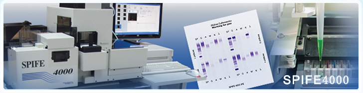 海伦娜SPIFE4000全自动电泳仪